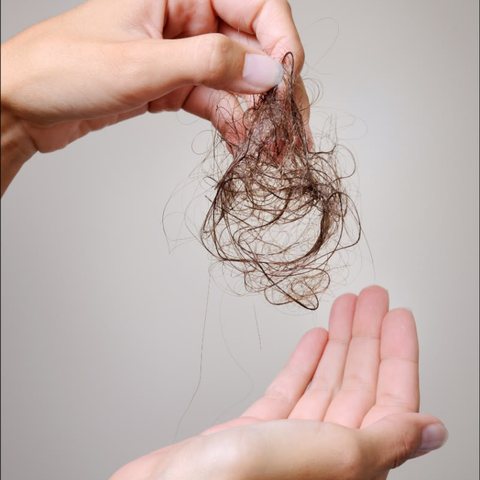 Fios de cabelo soltos na mão — eflúvio telógeno